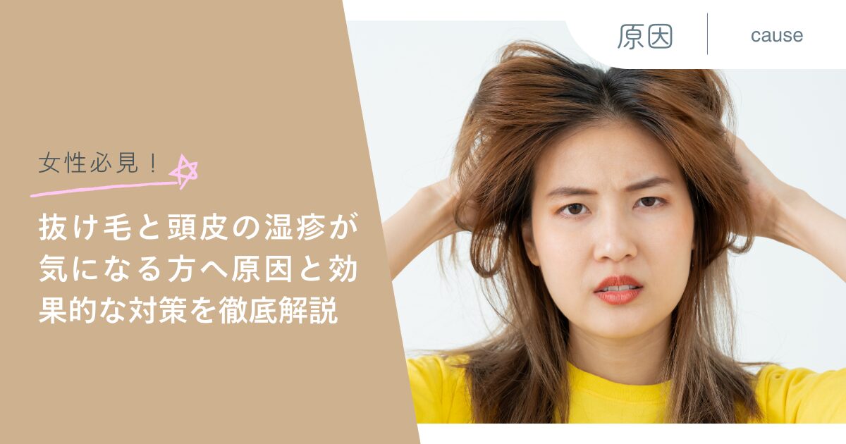 女性必見！抜け毛と頭皮の湿疹が気になる方へ原因と効果的な対策を徹底解説